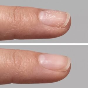 A deep clinical view of a damaged keratin matrix before and after a structural nail reformation treatment